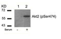 Western blot analysis of extracts from 293 cells untreated(lane 1) or treated with serum(lane 2) using Akt2(Phospho-Ser474) Antibody.