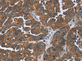 GAB2 Antibody – Figure 1 of 3