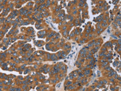 GAB2 Antibody – Figure 1 of 3