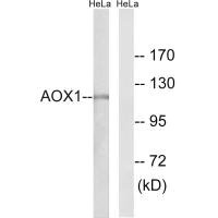 Western blot analysis of extracts from HeLa cells, using AOX1 antibody.