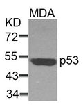 Western blot analysis of extracts from MDA cells using p53(Ab-37) Antibody.