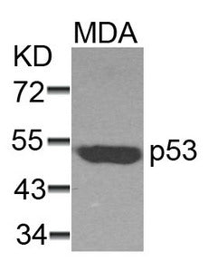 Western blot analysis of extracts from MDA cells using p53(Ab-37) Antibody.