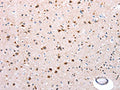 The image on the left is immunohistochemistry of paraffin-embedded Human brain tissue using CSB-PA924099(NDUFA12 Antibody) at dilution 1/50, on the right is treated with synthetic peptide. (Original magnification: ×200)