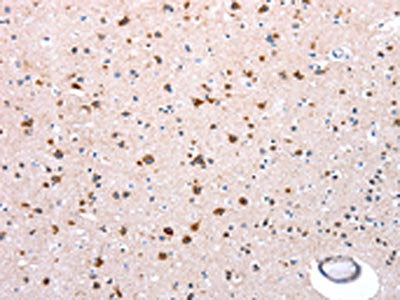 The image on the left is immunohistochemistry of paraffin-embedded Human brain tissue using CSB-PA924099(NDUFA12 Antibody) at dilution 1/50, on the right is treated with synthetic peptide. (Original magnification: ×200)