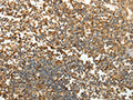 The image on the left is immunohistochemistry of paraffin-embedded Human tonsil tissue using CSB-PA924520(SFTPD Antibody) at dilution 1/30, on the right is treated with fusion protein. (Original magnification: ×200)