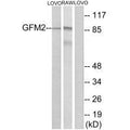 Western blot analysis of extracts from LOVO cells and RAW264.7cells, using GFM2 antibody.