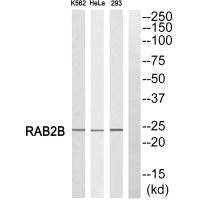 Western blot analysis of extracts from K562 cells, HeLa cells and 293 cells, using RAB2B antibody.
