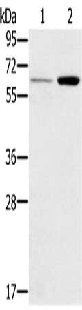 Gel: 8%SDS-PAGE, Lysate: 40 ug, Lane 1-2: Human liver tissue, mouse kidney tissue, Primary antibody: CSB-PA925190(TNFRSF11A Antibody) at dilution 1/200, Secondary antibody: Goat anti rabbit IgG at 1/8000 dilution, Exposure time: 1 minute