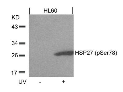 Western blot analysis of extracts from HL60 cells untreated or treated with UV using HSP27(Phospho-Ser78) Antibody.