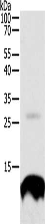 Gel: 12%SDS-PAGE, Lysate: 40 ug, Lane: 293T cells, Primary antibody: CSB-PA925623(TNFRSF12A Antibody) at dilution 1/300, Secondary antibody: Goat anti rabbit IgG at 1/8000 dilution, Exposure time: 30 seconds
