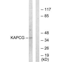 Western blot analysis of extracts from COLO205 cells, using KAPCG antibody.