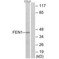 Western blot analysis of extracts from Jurkat cells, 293 cells and HUVEC cells, using FEN1 antibody.