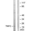 Western blot analysis of extracts from HepG2 cells, using TNFC antibody.