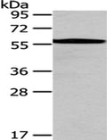 Gel: 8%SDS-PAGE,Lysate: 40 ug,,Primary antibody: CSB-PA927149(CHEK1 Antibody) at dilution 1/200 dilution,Secondary antibody: Goat anti rabbit IgG at 1/8000 dilution,Exposure time: 10 minutes