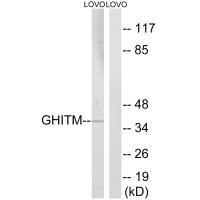 Western blot analysis of extracts from LOVO cells, using GHITM antibody.