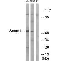Western blot analysis of extracts from JK and K562 cells, using Smad1 (Ab-187) antibody.