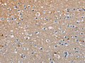 The image on the left is immunohistochemistry of paraffin-embedded Human brain tissue using CSB-PA927593(AMBRA1 Antibody) at dilution 1/50, on the right is treated with fusion protein. (Original magnification: ×200)
