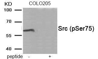 Western blot analysis of extracts from COLO205 tissue using Src (Phospho-Ser75) antibody.The lane on the right is treated with the antigen-specific peptide.