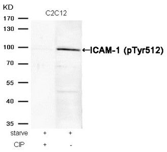 Western blot analysis of extracts from C2C12 cells, treated with starve or calf intestinal phosphatase (CIP), using ICAM-1 (Phospho-Tyr512) Antibody.
