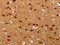 The image on the left is immunohistochemistry of paraffin-embedded Human brain tissue using CSB-PA928820(PSMD3 Antibody) at dilution 1/25, on the right is treated with fusion protein. (Original magnification: ×200)