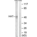 Western blot analysis of extracts from K562 cells, using HAT antibody.