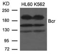 Western blot analysis of extracts from HL60 and K562 cells using Bcr(Ab-177) Antibody.