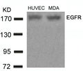 Western blot analysis of extracts from HUVEC and MDA cells using EGFR(Ab-678) Antibody.