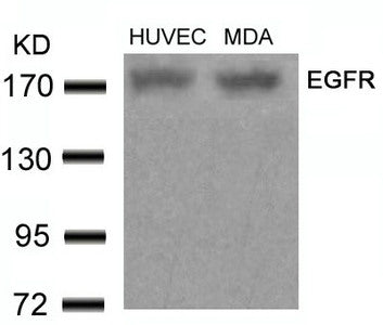 Western blot analysis of extracts from HUVEC and MDA cells using EGFR(Ab-678) Antibody.