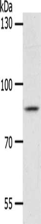 Gel: 8%SDS-PAGE, Lysate: 40 ug, Lane: Hela cells, Primary antibody: CSB-PA929390(ANKRD28 Antibody) at dilution 1/1050, Secondary antibody: Goat anti rabbit IgG at 1/8000 dilution, Exposure time: 2 hours