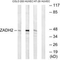 Western blot analysis of extracts from COLO cells, HUVEC cells and HT-29 cells, using ZADH2 antibody.