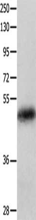 Gel: 10%SDS-PAGE, Lysate: 60 ug, Lane: Human colon cancer tissue, Primary antibody: CSB-PA929836(KRT23 Antibody) at dilution 1/100, Secondary antibody: Goat anti rabbit IgG at 1/8000 dilution, Exposure time: 1 minute