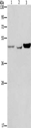 Gel: 8%SDS-PAGE, Lysate: 40 ug, Lane 1-3: A431 cells, A549 cells, hela cells, Primary antibody: CSB-PA930021(ACP2 Antibody) at dilution 1/150, Secondary antibody: Goat anti rabbit IgG at 1/8000 dilution, Exposure time: 40 seconds