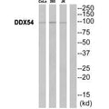 Western blot analysis of extracts from CoLo cells, 293 cells and JurKat cells, using DDX54 antibody.