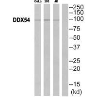 Western blot analysis of extracts from CoLo cells, 293 cells and JurKat cells, using DDX54 antibody.