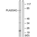 Western blot analysis of extracts from Jurkat cells, using PLA2G4C antibody.