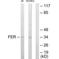 Western blot analysis of extracts from JK and HUVEC cells, using FER antibody.