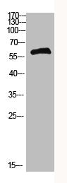 Western Blot analysis of HEPG2 cells using Antibody diluted at 500. Secondary antibody  was diluted at 1:20000