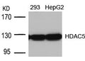 Western blot analysis of extracts from 293 and HepG2 cells using HDAC5(Ab-498) Antibody.