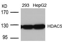 Western blot analysis of extracts from 293 and HepG2 cells using HDAC5(Ab-498) Antibody.