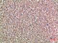Immunohistochemical analysis of paraffin-embedded human-liver, antibody was diluted at 1:200