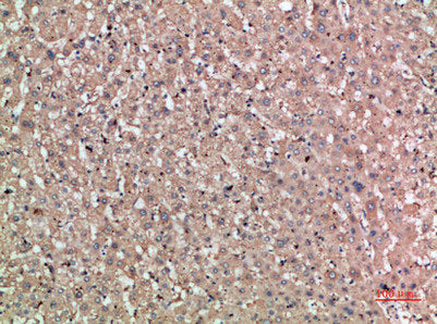 Immunohistochemical analysis of paraffin-embedded human-liver, antibody was diluted at 1:200