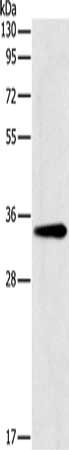 Gel: 10%SDS-PAGE, Lysate: 40 ug, Lane: Mouse liver tissue, Primary antibody: CSB-PA931421(GNMT Antibody) at dilution 1/200, Secondary antibody: Goat anti rabbit IgG at 1/8000 dilution, Exposure time: 5 seconds