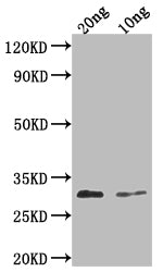 Western Blot
Positive WB detected in Recombinant protein
All lanes: PDF2.3 antibody at 1:2000
Secondary
Goat polyclonal to rabbit IgG at 1/50000 dilution
Predicted band size: 32 kDa
Observed band size: 32 kDa