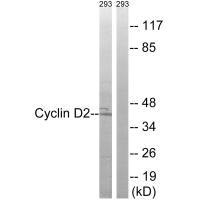 Western blot analysis of extracts from 293 cells, using Cyclin D2 (Ab-280) antibody.