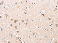 The image on the left is immunohistochemistry of paraffin-embedded Human brain tissue using CSB-PA932466(ADAM15 Antibody) at dilution 1/35, on the right is treated with fusion protein. (Original magnification: ×200)