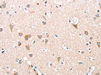 The image on the left is immunohistochemistry of paraffin-embedded Human brain tissue using CSB-PA932466(ADAM15 Antibody) at dilution 1/35, on the right is treated with fusion protein. (Original magnification: ×200)