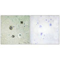 Immunohistochemistry analysis of paraffin-embedded human brain tissue using CDK5 (Ab-15) antibody.