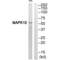 Western blot analysis of extracts from HeLa cells, 293 cells and Jurkat cells, using MAPK10 antibody.