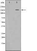 Western blot analysis of c-Met expression in HepG2 whole cell lysates, The lane on the left is treated with the antigen-specific peptide.