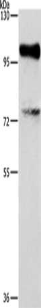 Gel: 8%SDS-PAGE, Lysate: 40 ug, Lane: K562 cells, Primary antibody: CSB-PA934125(EZH2 Antibody) at dilution 1/300, Secondary antibody: Goat anti rabbit IgG at 1/8000 dilution, Exposure time: 15 seconds